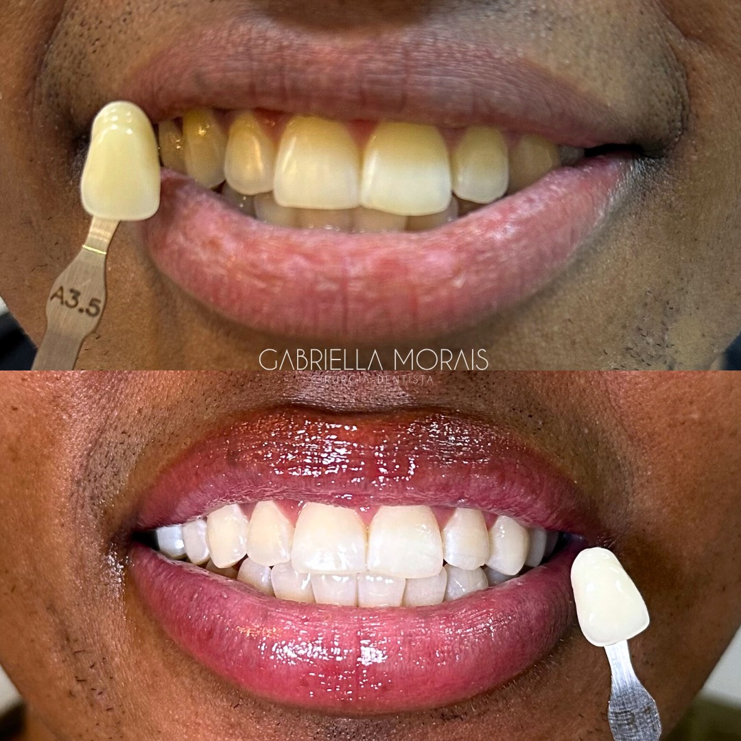 Caso 8 - Antes e Depois